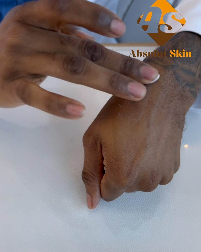 Dr. Romario Thomas with Absolut Skin Corticosoothe